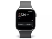 Apple Os usuários de relógios já podem monitorar seus níveis de açúcar no sangue ao usar dispositivos Dexcom. (Fonte da imagem: Dexcom)