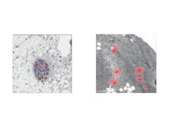 Organização espacial e específica do tecido da senescência celular (um processo no qual as células danificadas ou envelhecidas param de se dividir, mas permanecem ativas). (Fonte da imagem: The Lancet Digital Health)